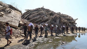 Gaza’s hungry children worsen as emergency aid dwindles