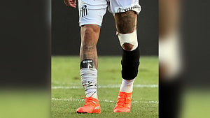 Neymar to undergo knee surgery