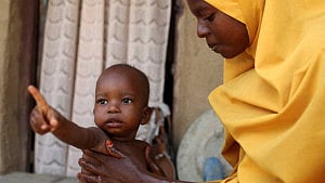 At least 652 Nigerian children die from malnutrition in 6 months