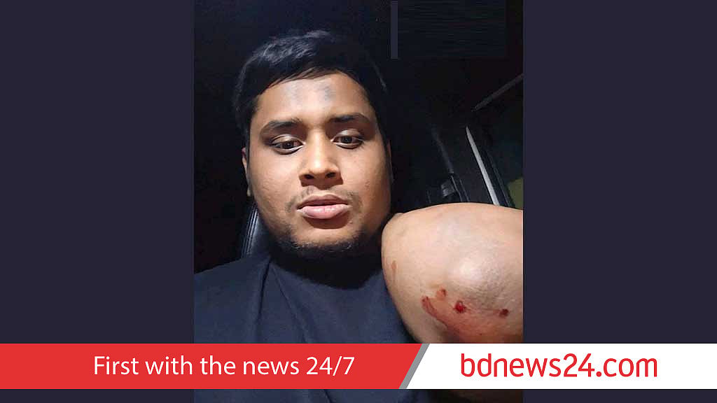 54 held over attack on Hasnat’s car