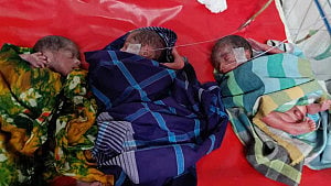 5 of 6 infants die after premature birth at DMCH