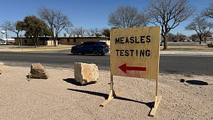 US fights to keep measles elimination status