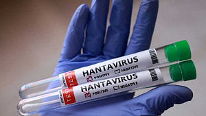 Hantavirus risk to US public low: CDC