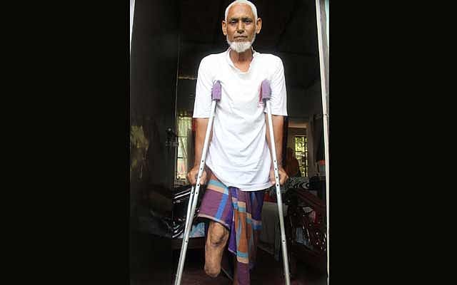 পায়ের দিকে তাকাতে আঁতকে উঠি, গোড়ালি উড়ে গেছে, চামড়ার আবরণ নেই, হাড্ডি গুঁড়ো হয়েছে, রগগুলো ঝুলছে গাছের শিকড়ের মতো পায়ের দিকে তাকাতে আঁতকে উঠি, গোড়ালি উড়ে গেছে, চামড়ার আবরণ নেই, হাড্ডি গুঁড়ো হয়েছে, রগগুলো ঝুলছে গাছের শিকড়ের মতো