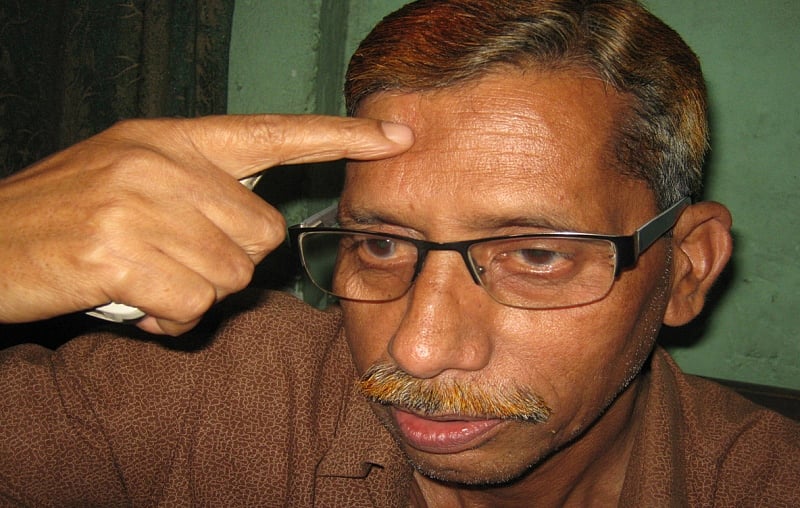 কপালে স্প্লিন্টারের দাগ দেখাচ্ছেন মুক্তিযোদ্ধা মতিউর রহমান 
