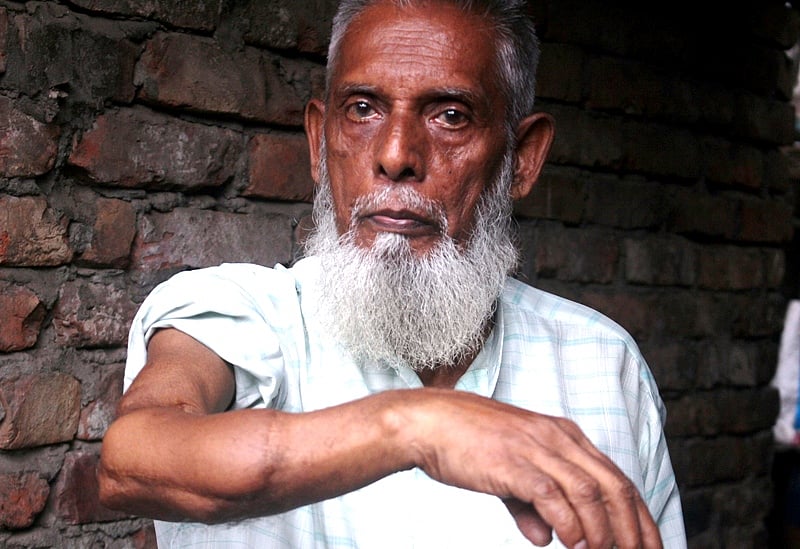 পাকিস্তানি সেনাদের গুলিতে জসিম উদ্দিনের ডান হাতের কব্জির ওপরের হাড় গুড়ো হয়ে যায় 