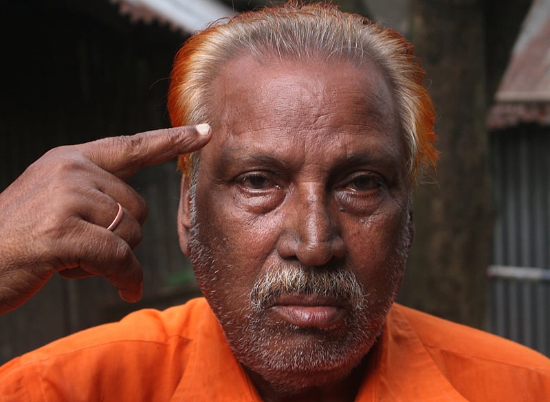 আচকির আহমেদের মাথায় গুলিরবিদ্ধ হওয়ার চিহ্ন 