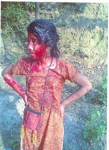 Unidentified Jumma girl injured in the attack - photo taken at Jaliapara by a Marma police on 17 April 2011. 
