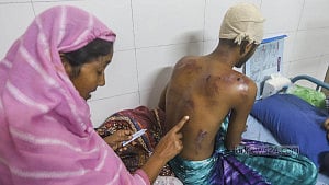 হাসপাতালে চিকিৎসায় শিক্ষার্থীরা