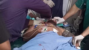 হাদিকে এয়ার অ্যাম্বুলেন্সে সিঙ্গাপুর নেওয়া হচ্ছে