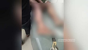 আখেরি মোনাজাতের পর ‘ঠেলাঠেলি’, গরম পানিতে দগ্ধ ৪