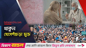 ‘নীরব মহামারী’ হতে পারে খোসপাঁচড়া?