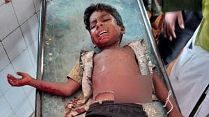 1 child dies, 2 more injured in Jashore bomb blast