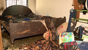 Another Ctg burn victim dies, fatalities rise to 4