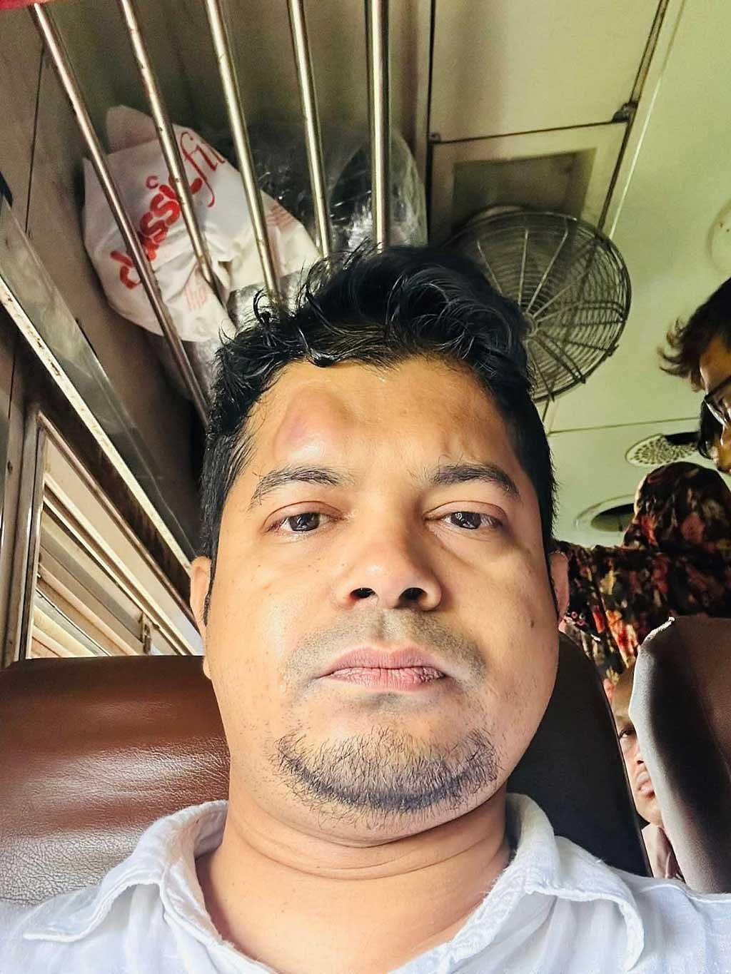 ট্রেনে পাথর হামলার শিকার চিকিৎসক ছিদ্দিক মজুমদার।