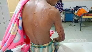 Farmer injured in BSF firing