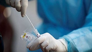 Measles test kits running low, only 13 left