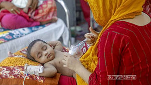 Measles surge overwhelms COVID hospital